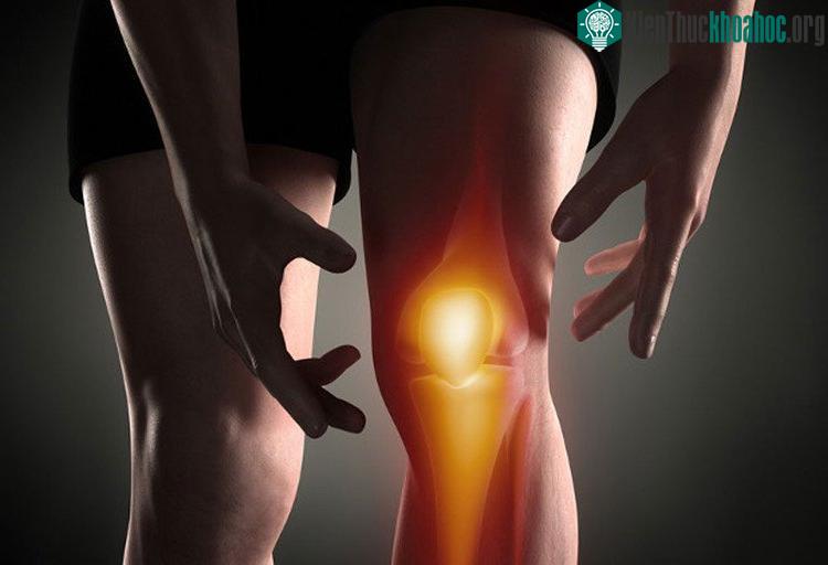 Nữ thường mắc các bệnh lý về khớp gối nhiều hơn nam.