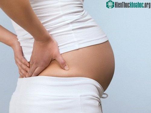 Đau lưng khi mang thai