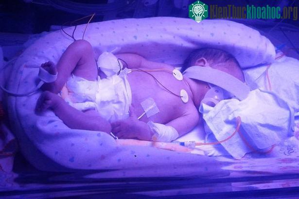 Người mẹ đã qua đời nhưng dấu hiệu sự sống của đứa bé trong bụng cô là rất tốt.