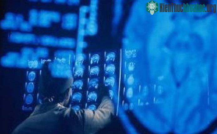 Các bệnh nhân sẽ được theo dõi bằng máy MRI trong nhiều tháng.