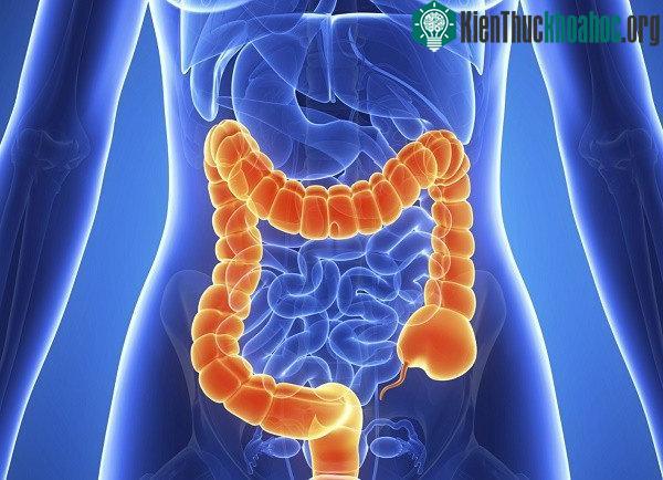 Ung thư đại trực tràng là loại ung thư phổ biến thứ 2 ở nam giới.