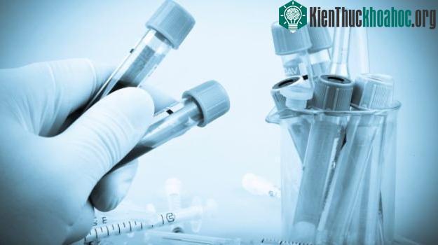 Chi phí sản xuất lớn và thời gian là hai trở ngại của vaccine mới.