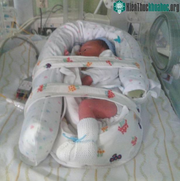 Em bé trong bụng Sandra được sinh ra ở tuần thứ 32 thai kỳ.