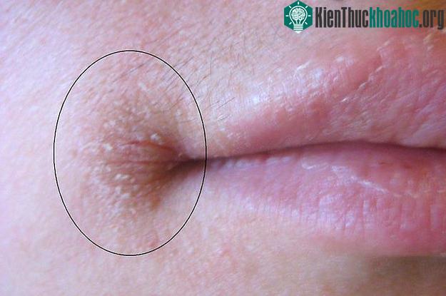Cơ thể là một cỗ máy hoàn hảo, mà bất kỳ trục trặc nào cũng sẽ được bộc lộ qua nhiều dấu hiệu khác nhau. Xem thêm tại đây