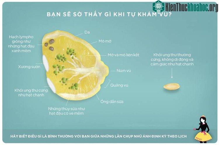 Núm vú lõm cũng có thể là một triệu chứng báo hiệu ung thư vú.