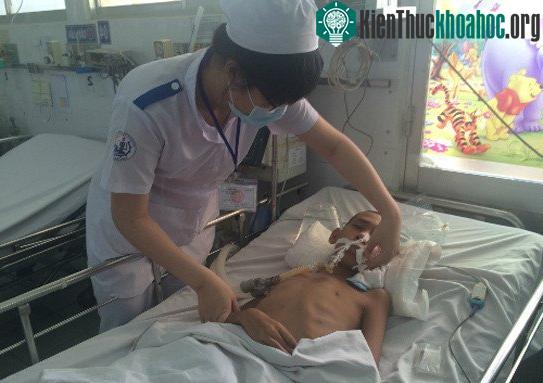 Bệnh nhi điều trị viêm não tại Khoa Nhiễm BV Nhi đồng 1 (TP HCM). (Ảnh: Lê Phương).