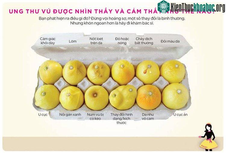 Thói quen sống lành mạnh sẽ góp phần làm giảm nguy cơ mắc bệnh.