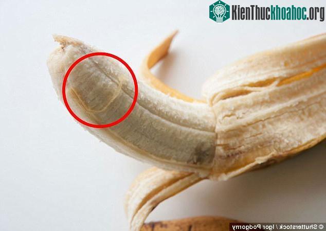 Những sợi xơ này mặc dù có thể khiến bạn khó chịu nhưng chúng lại rất quan trọng.