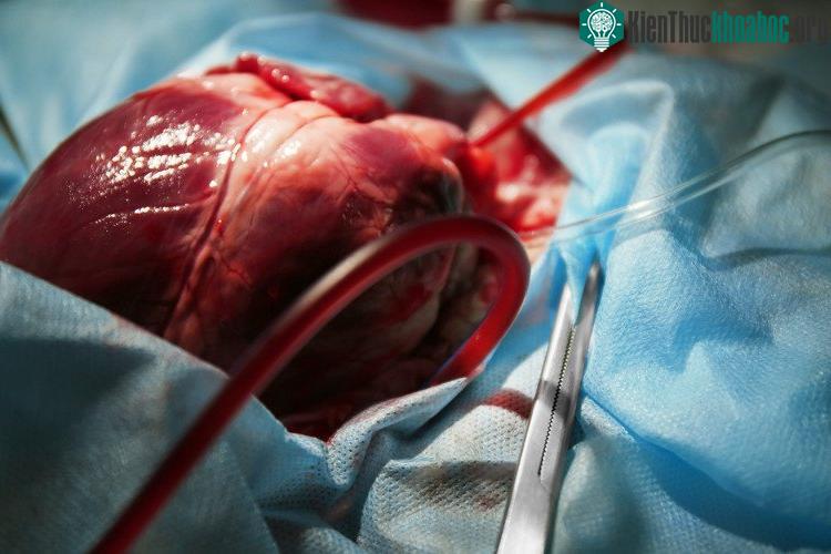 Tiến sĩ Duong Nguyen, một nhà nghiên cứu gốc Việt đang làm việc cho tập đoàn dược phẩm ở Thụy Điển đã chỉ đạo nghiên cứu.