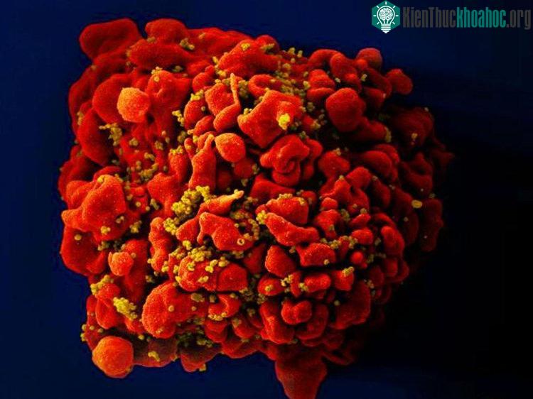 Người nhiễm HIV phải uống thuốc hàng ngày với chi phí tốn kém và phải chịu nhiều phản ứng phụ.