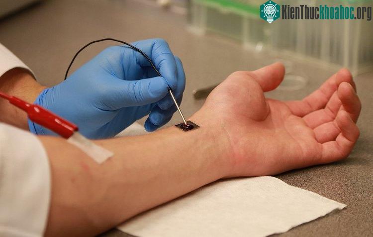 Con chip tái tạo tế bào trên tay bệnh nhân. (Ảnh: Đại học Ohio).