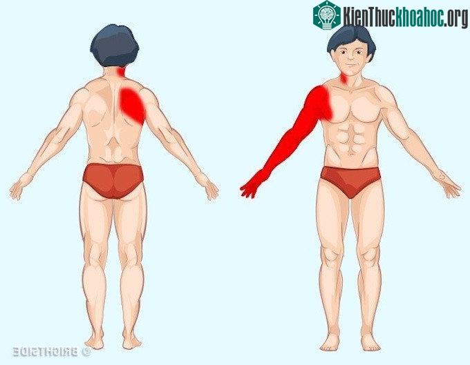 Cơn đau bên ngoài cơ thể có thể dự đoán vấn đề bên trong.