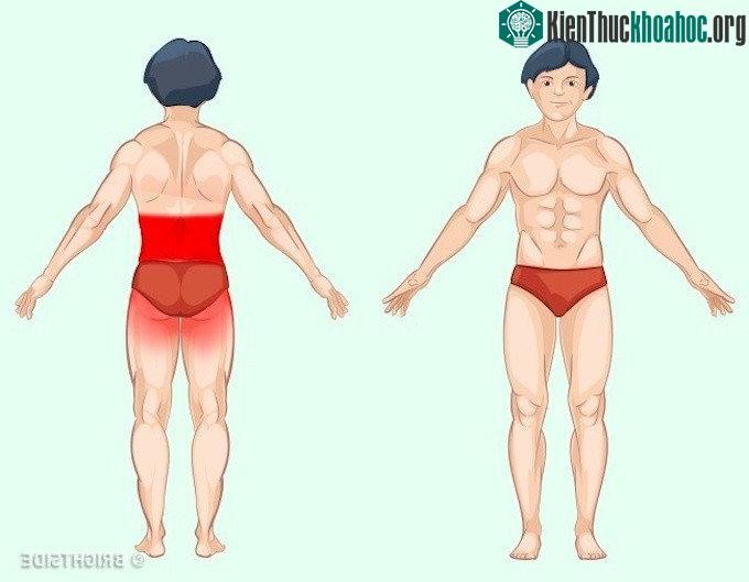 Cơn đau do thận nằm sâu bên dưới xương sườn, đôi khi bị nhầm với đau lưng