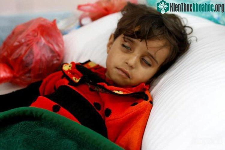 Suy dinh dưỡng tạo điều kiện cho bệnh tả phát triển. (Ảnh: Reuters).