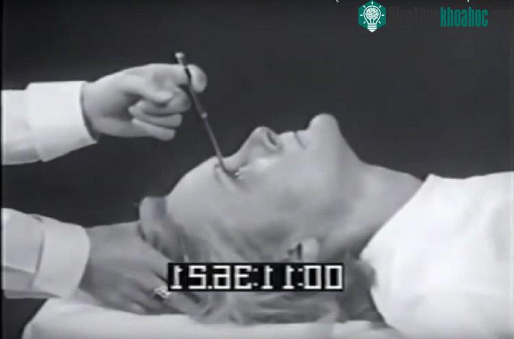 Phương pháp này khá phổ biến vào cuối thập niên 1930.