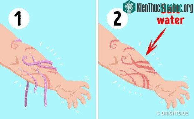 Rửa sạch vết thương bằng nước muối.