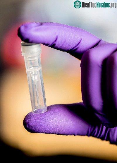 Lấy sợi DNA độc hại từ một mẫu bệnh phẩm là rất khó khăn với nhiều thách thức kỹ thuật.