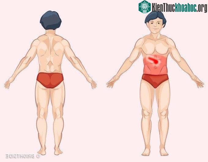 Bệnh về tụy được biểu hiện bằng cơn đau ở giữa bụng trên