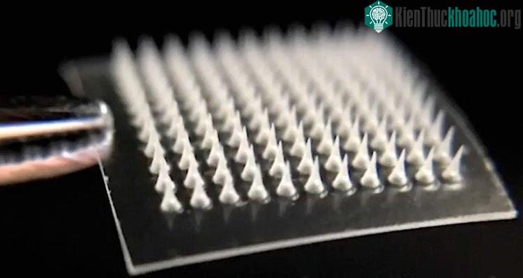 Miếng dán gồm rất nhiều mũi kim siêu nhỏ có thể đánh tan mỡ thừa hiệu quả. (Ảnh: Sciencealert).