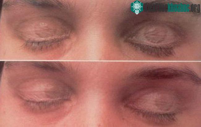 Việc nhắm mắt khi ngủ giống như ta