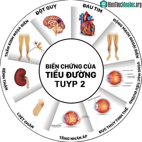 Tiểu đường tuýp 2 chính là sát thủ giết người thầm lặng dẫn tới nhiều căn bệnh khác. (Ảnh: benhtieuduong.net.vn)