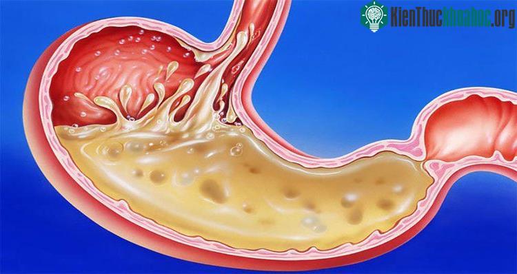 Dạ dày có chức năng nghiền nhỏ và phân hủy hóa học thức ăn. (Ảnh: Collective Evolution).