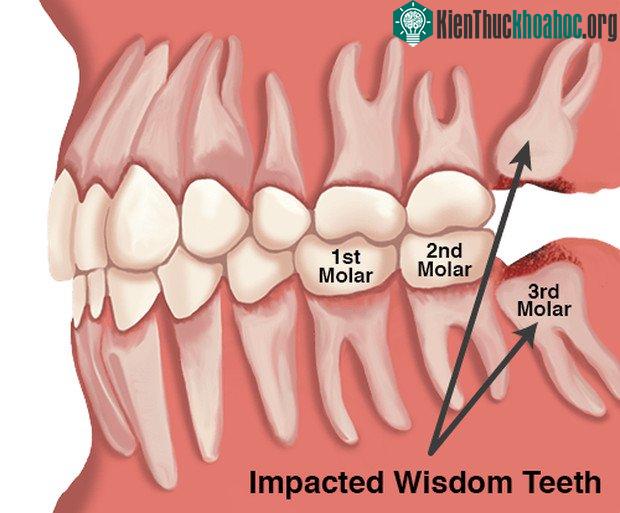 PAX9 là yếu tố phiên mã quan trọng trong phát triển răng, đặc biệt là răng khôn ở người.