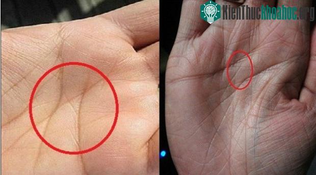 Người có kí tự X trên lòng bàn tay hầu hết là những người có phẩm chất lãnh đạo.