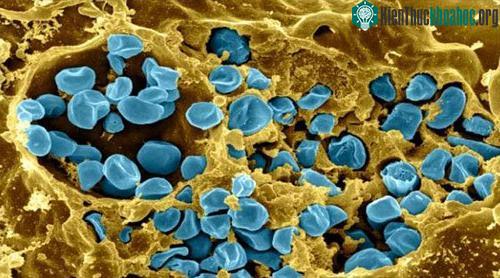 Vi khuẩn gây bệnh tularemia. (Ảnh: Futurism).