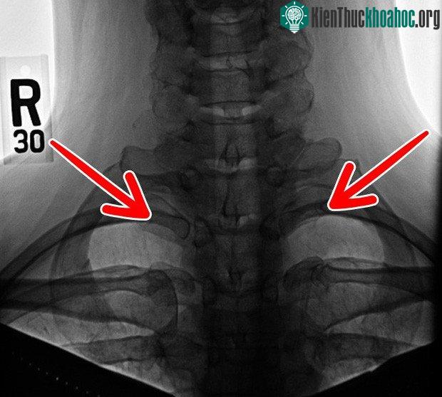 Rất nhiều bộ phận cơ thể chúng ta sẽ "tiêu tan" trong tương lai, và đó là... ảnh 3