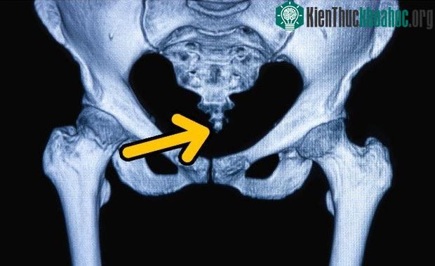 Rất nhiều bộ phận cơ thể chúng ta sẽ "tiêu tan" trong tương lai, và đó là... ảnh 5