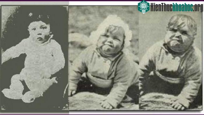 Bức ảnh em bé Hitler