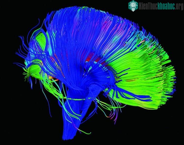 Thay đổi mạch não để loại trừ cơn đau. (Ảnh: NICHD).