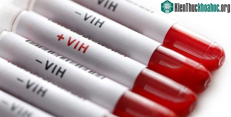 Một loại thuốc được sử dụng để điều trị ung thư phổi, thận và da có thể tiêu diệt các tế bào nhiễm virus HIV.