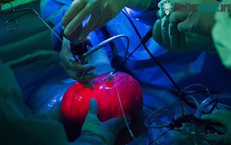 Tử cung người mẹ được tạm lấy ra, bơm căng, chiếu sáng, trong khi các bác sĩ dùng dụng cụ nội soi để gây mê và phẫu thuật cho em bé bên trong - (Ảnh do nhóm nghiên cứu cung cấp).