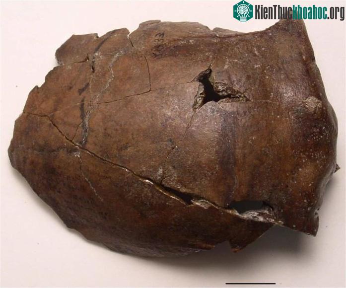 Hộp sọ của nạn nhân sóng thần cách đây 6000 năm tại Papua New Guinea. (Ảnh: BBC.)