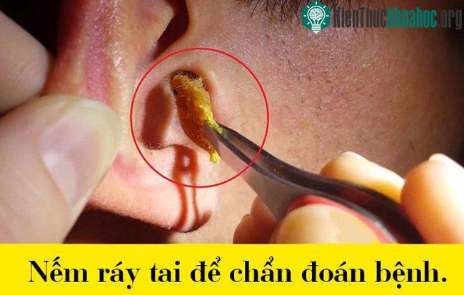 Nếm ráy tai để