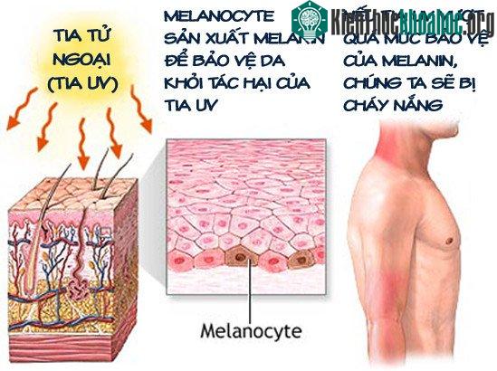 Sắc tố da