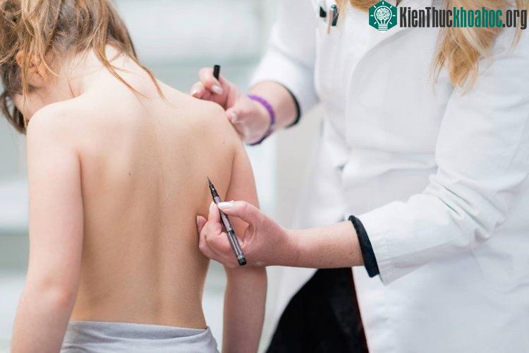 Kiểm tra cột sống trẻ để sớm phát hiện tình trạng cong vẹo.