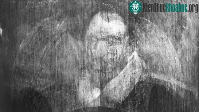 Hình chụp X–quang cho thấy bóng dáng một người phụ nữ phía sau. (Ảnh: Iflscience).