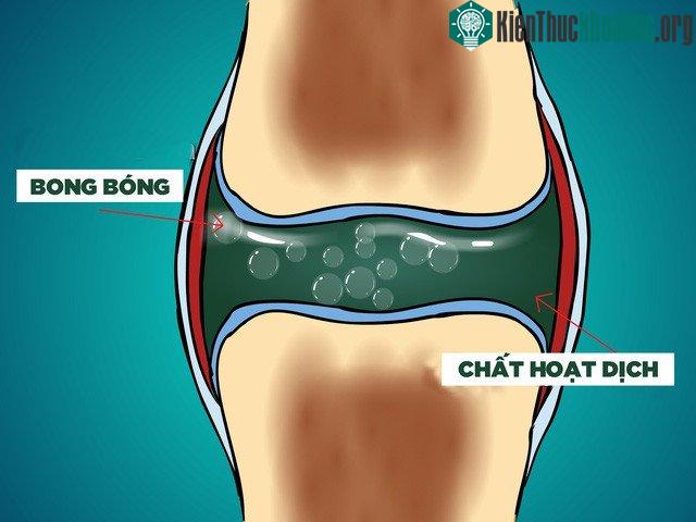 Những bong bóng trong chất hoạt dịch là nguồn gốc của tiếng lục khục khi bẻ khớp.