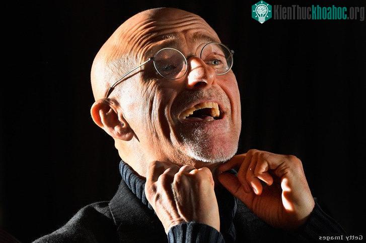 Bác sỹ Sergio Canavero. (Nguồn: Getty Images).