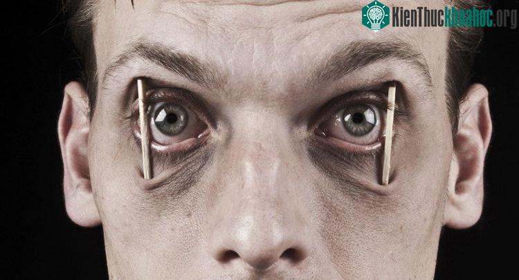 Việc thiếu ngủ sẽ gây ra nhiều hệ lụy không tốt cho sức khỏe.