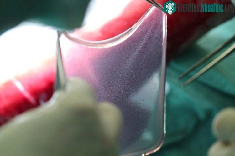 Một mảnh da chuẩn bị được ghép - (Ảnh do nhóm nghiên cứu cung cấp).