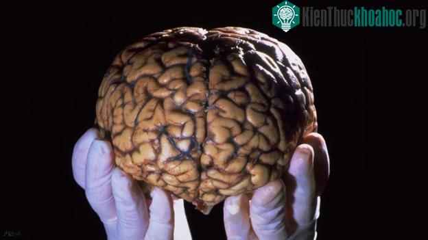 Ý thức con người có thể đến theo nhiều cách khác nhau, không nhất thiết phải đi qua các trung khu thần kinh trong não bộ.