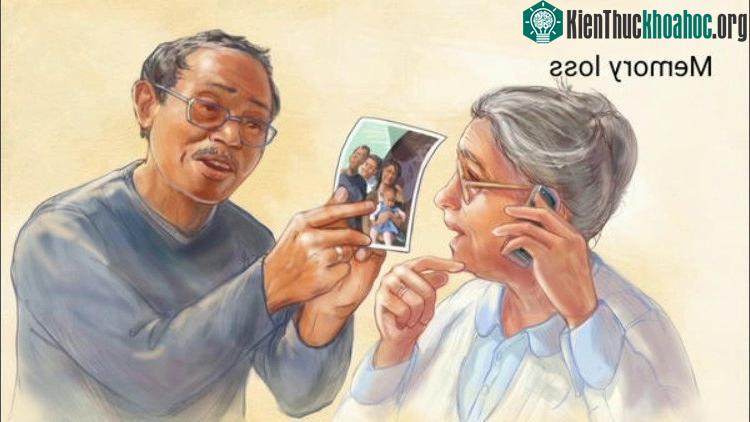 Liệu pháp siêu âm cho bệnh Alzheimer