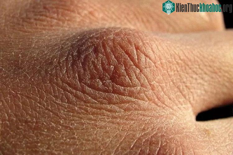 Lớp biểu bì ở động vật có vú có 2 màng ngăn vật lý trong 2 lớp trên cùng của biểu bì.