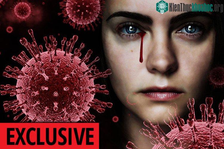 Tỉ lệ tử vong của bệnh gây ra do virus CCHF là khoảng 30%.