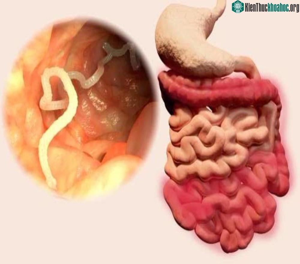 Tại sao chúng không bị tiêu hóa khi ở trong dạ dày của chúng ta?