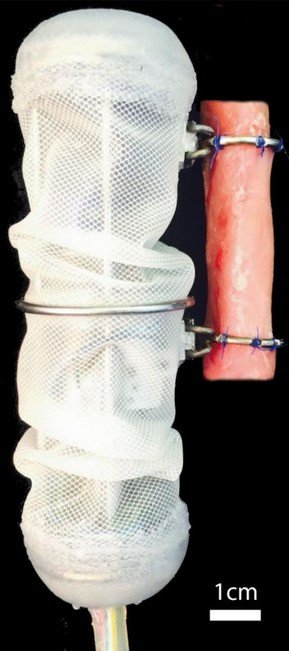Thiết bị robot được gắn vào một đoạn thực quản lợn. (Ảnh: Damian et al).